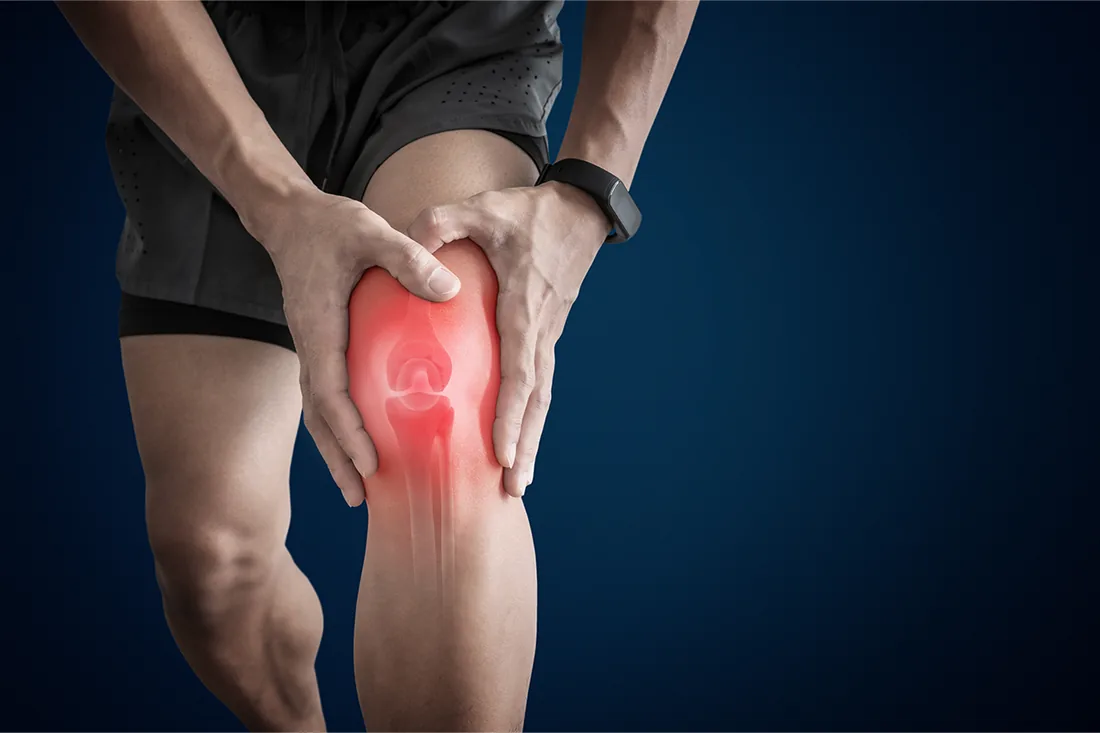 Arthritis