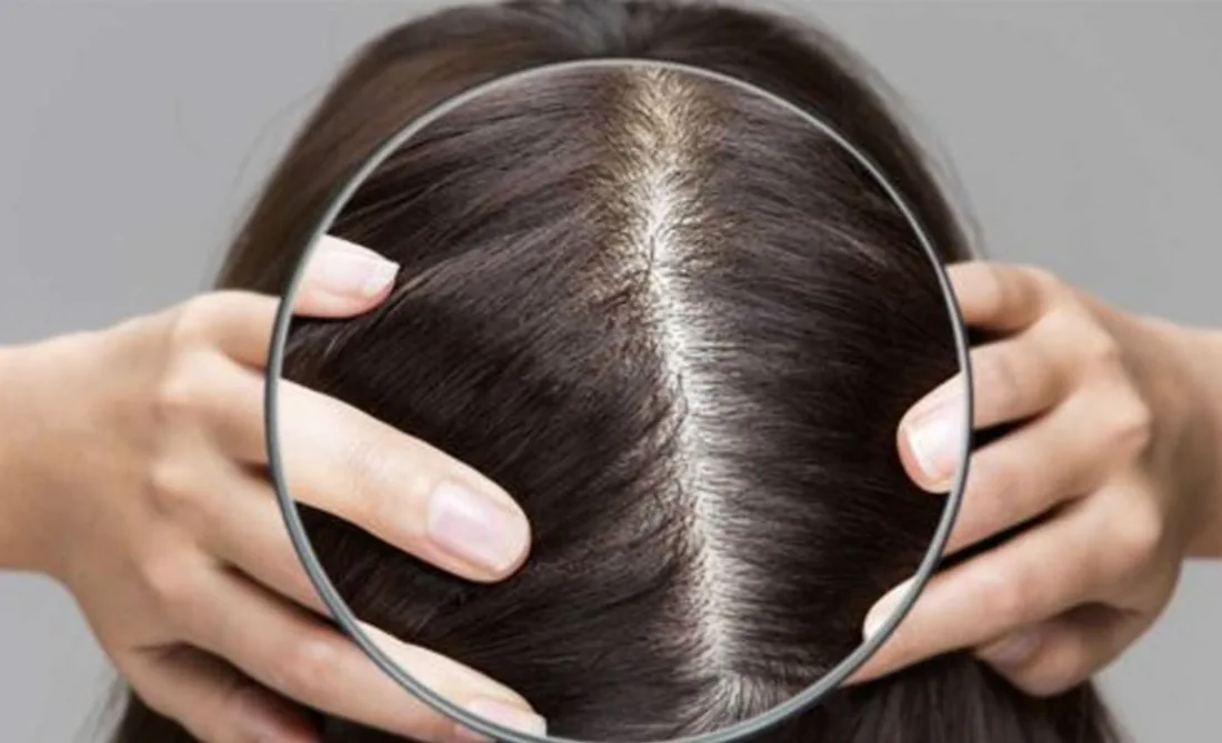 Epigenetic Hair Scan