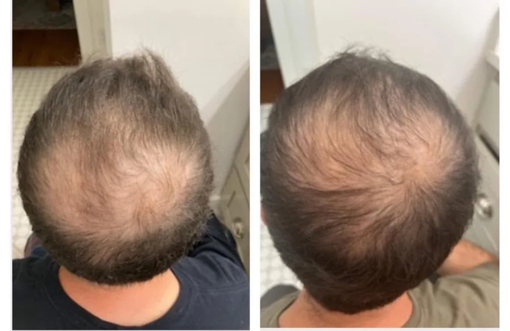 Epigenetic Hair Scan results at Magnolia Medical Group
